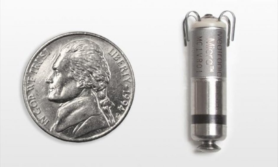 Ο πρώτος ασύρματος βηματοδότης στη Β. Ελλάδα εμφυτεύθηκε στο Διαβαλκανικό!