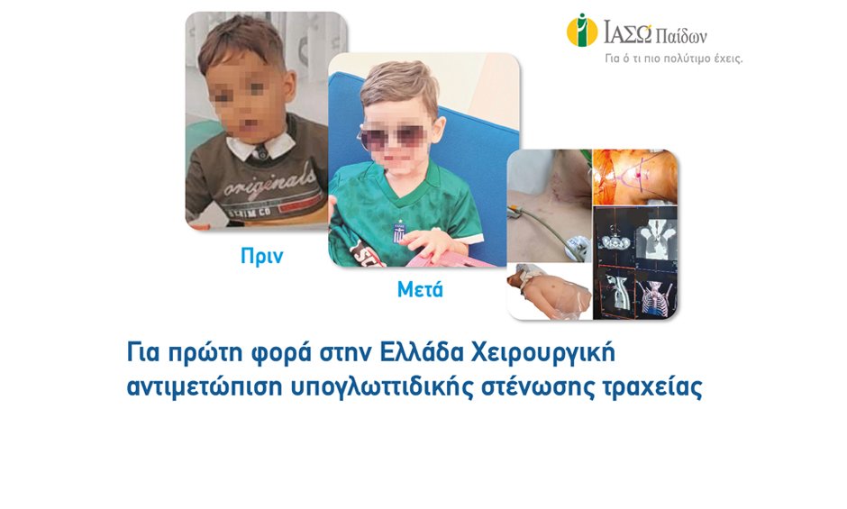 ΙΑΣΩ Παίδων: Για πρώτη φορά στην Ελλάδα χειρουργική αντιμετώπιση υπογλωττιδικής στένωσης τραχείας