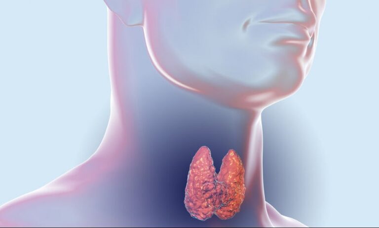 Καρκίνος θυρεοειδούς και χαρτογράφηση λεμφαδένων τραχήλου - Όσα πρέπει να γνωρίζετε από τον χειρουργό Γ. Σακοράφα