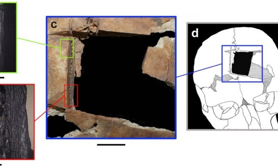 Βρέθηκε κρανίο με τετράγωνη τρύπα - Χειρουργείο εγκεφάλου πριν 3.500 χρόνια!