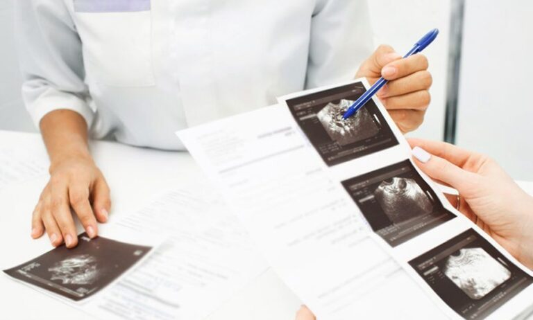 Η μόνιμη θεραπεία της πρόπτωσης του πυελικού εδάφους!